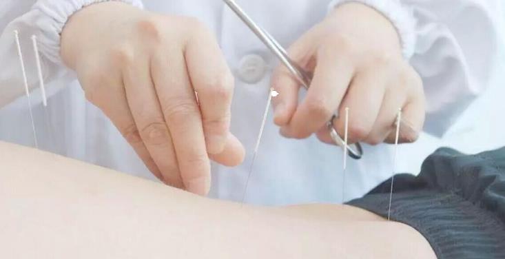 锦医堂中医门诊部针灸